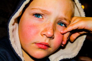 八个月助孕包生男孩脸上起红点的原因与护理 八个月助孕包生男孩脸上起红点的原因与护理